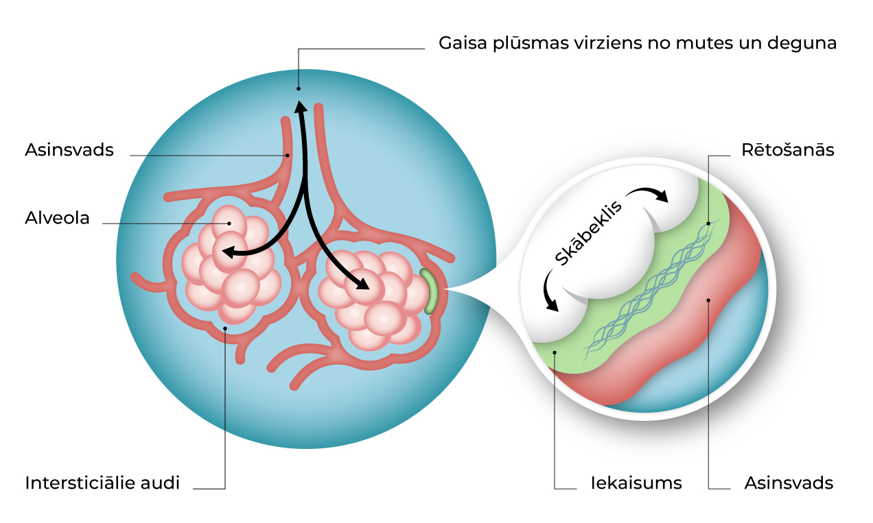 Plaušu saslimšana