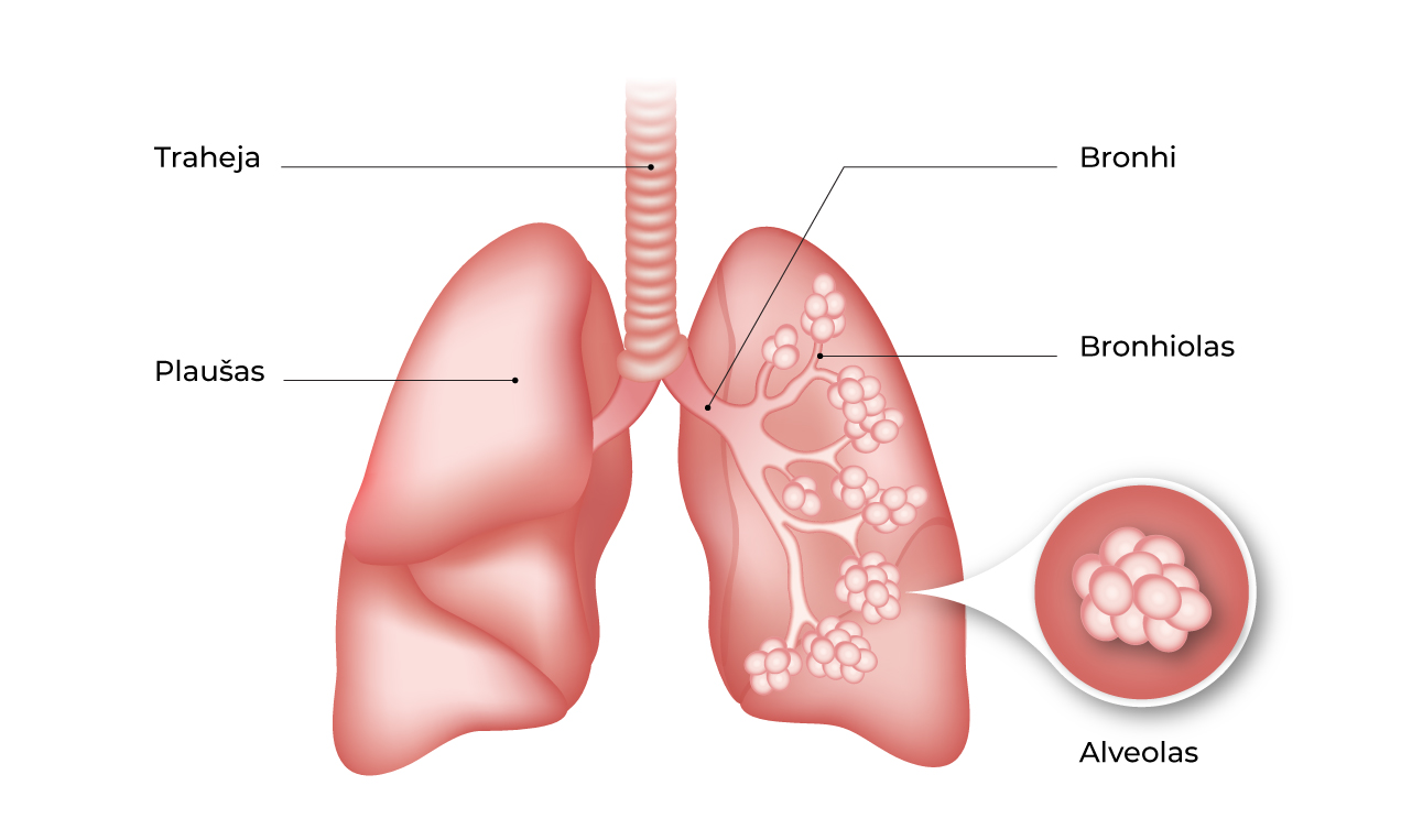 Plaušu saslimšana