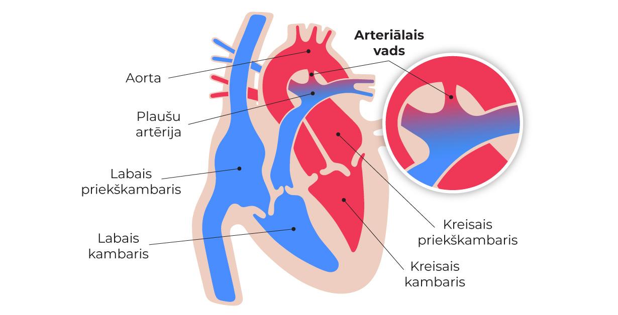 Sirds arteriālais vads
