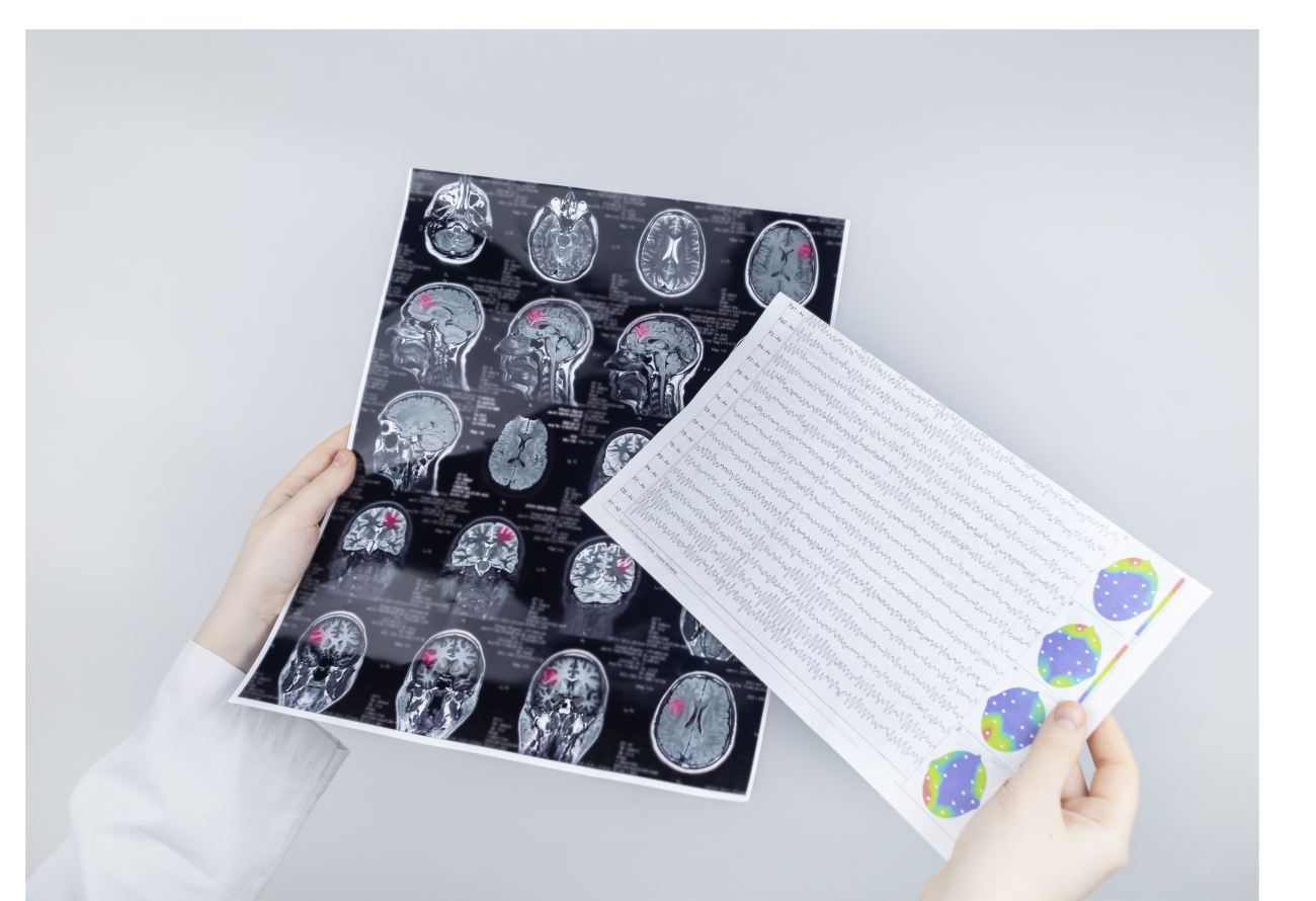 Epilepsijas pacienta sagatavošanās vizītei pie neirologa