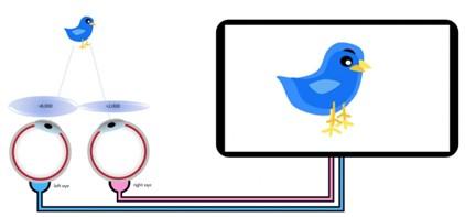 Saliktā anizometropija